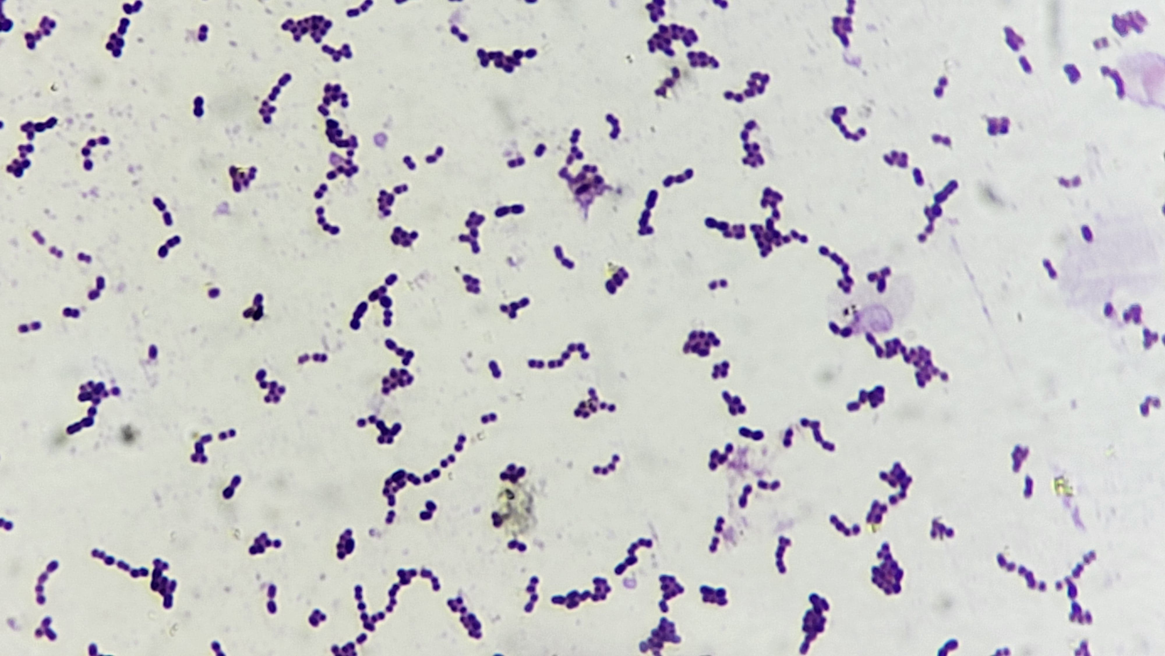 16. Streptococci  Microscopic (2)